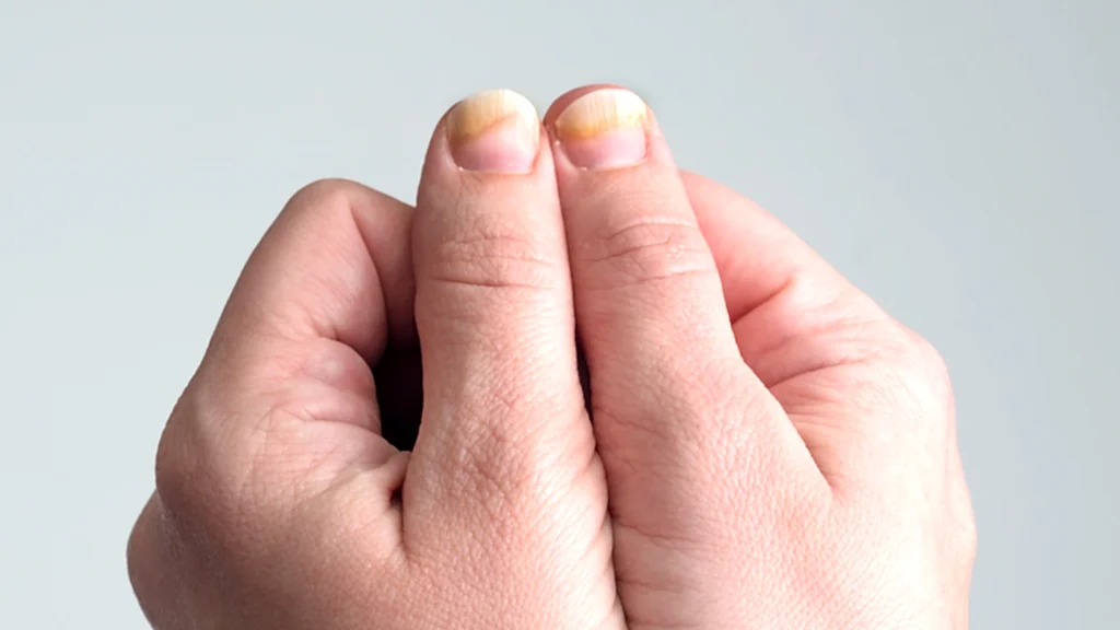 tırnak sağlığı doğal bakım yöntemleri